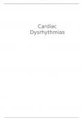 Cardiac-dysrhythmias.