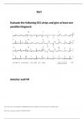  PROJECT MA pioneers ECG_TEST  Exam study guide