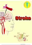 NEUROLOGY, STROKE WITH MANAGEMENT